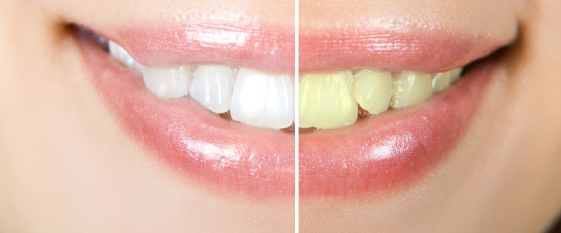 the-benefits-of-cosmetic-dentistry